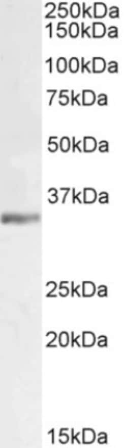 Lactate Dehydrogenase C Antibody, Novus Biologicals 0.1mg; Unlabeled:Antibodies,